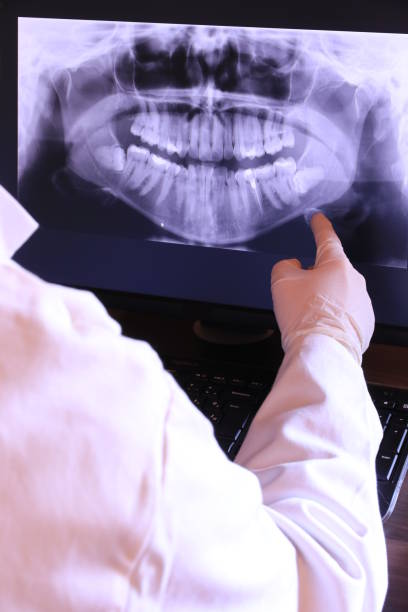 Best Emergency Root Canal Therapy in Toledo, IA